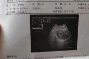 如何应对先兆流产？（早期预警、及时处理，保护宝宝健康）